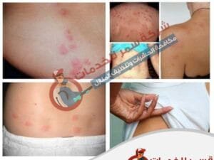 بق الفراش4